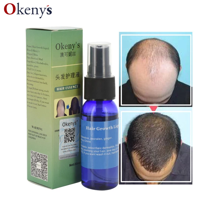 Yuda Pilatory Hair Growth Ginger Andrea Hair Loss Product Liquid Fast Hair Growth Spray Treatment 30ml Anti Gray Hair Essence