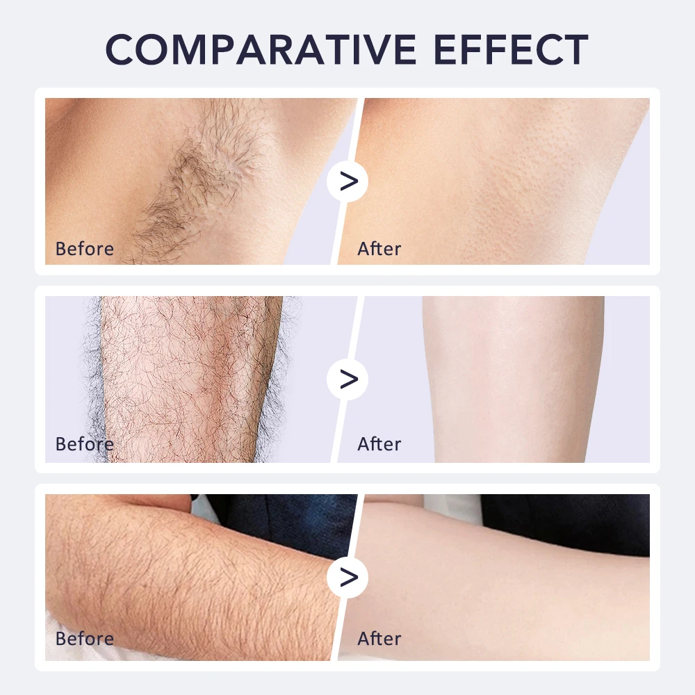 Painless Hair Remover Cream for Men and Women
