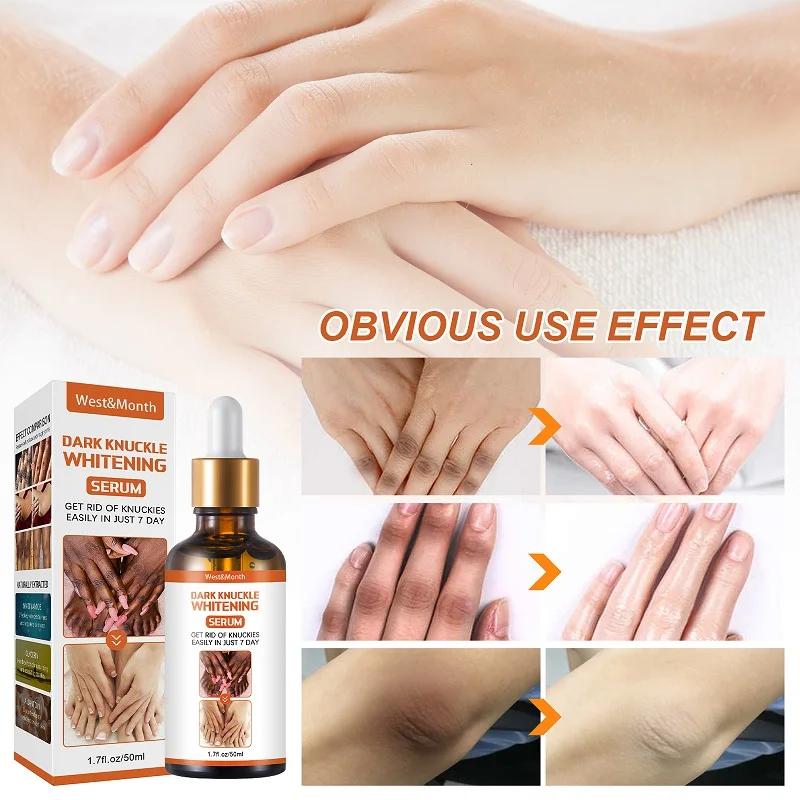 

50ML Joint De-blackening Beauty Serum Lighten Melanin Knee Ankle Corner Brighten Armpit Whitening Rejuvenation Bleaching