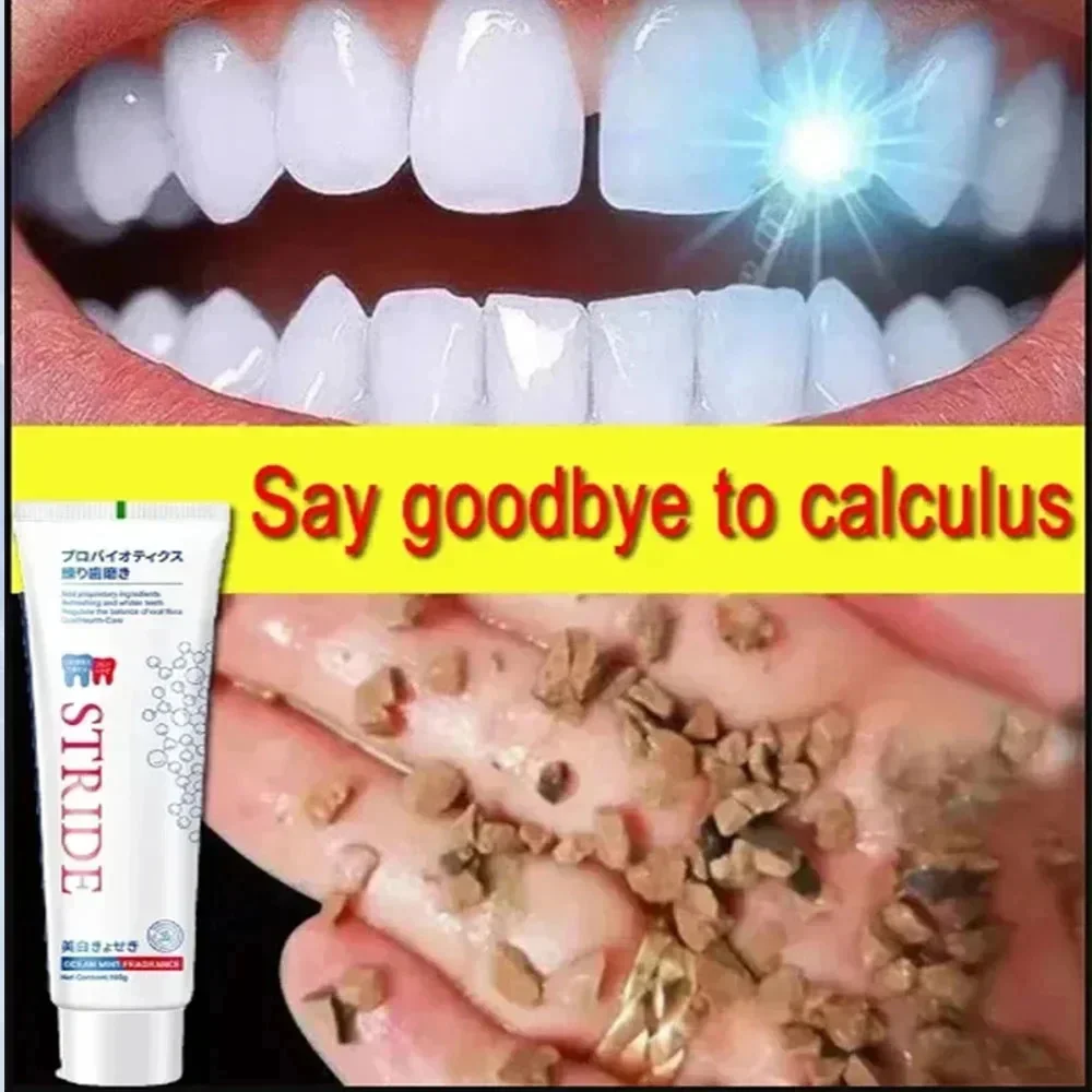 Dental Calculus Remover Teeth Whitening Toothpaste Oral Hygiene Cleaning Remove Plaque Stains Prevent Periodontitis Fresh Breath