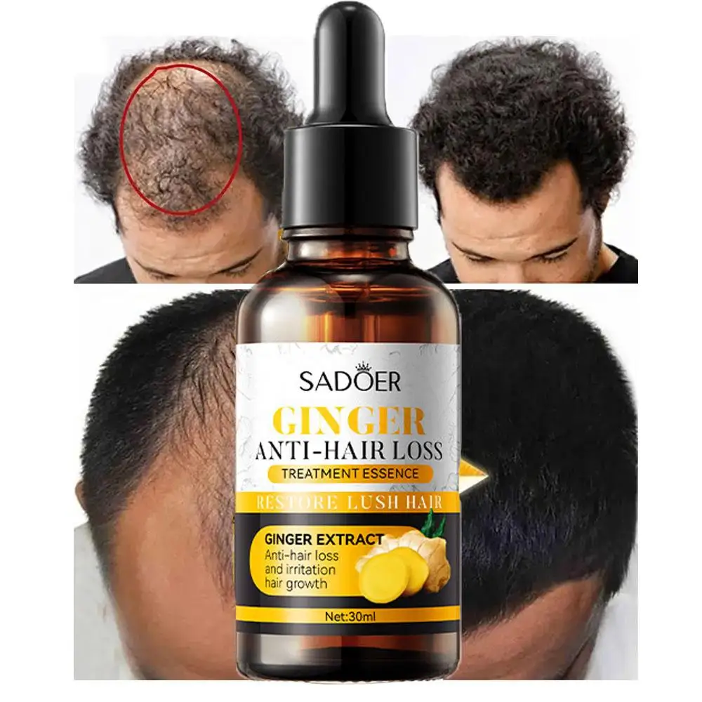 SADOER Deep Nourishing Moisturizing Thick Anti Hair Loss Stimulating Hair Follicle Growth Ginger Care Serum
