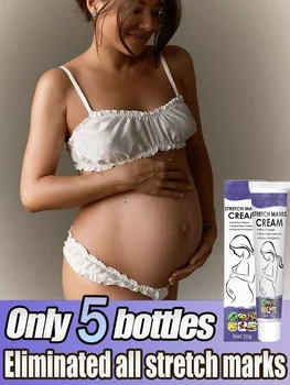 Removes Stretch Mark Cream To Remove Postpartum Obesity Pregnant Women Repair Anti-Aging Winkles Firming Body Cream Skin Care