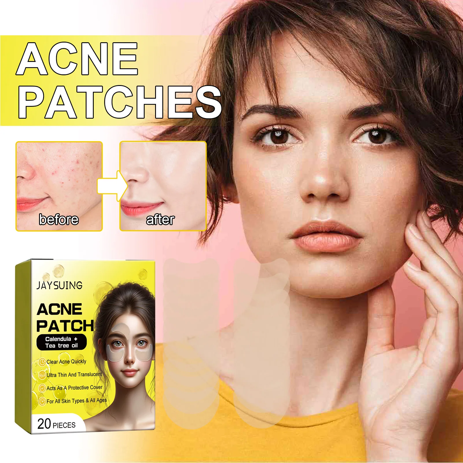 20Pcs Acne Hydrogel Patch Acne Remover Clean Acne Fade Red Marks Remove Blackheads Refine Pores Oil Control Facial Care Product