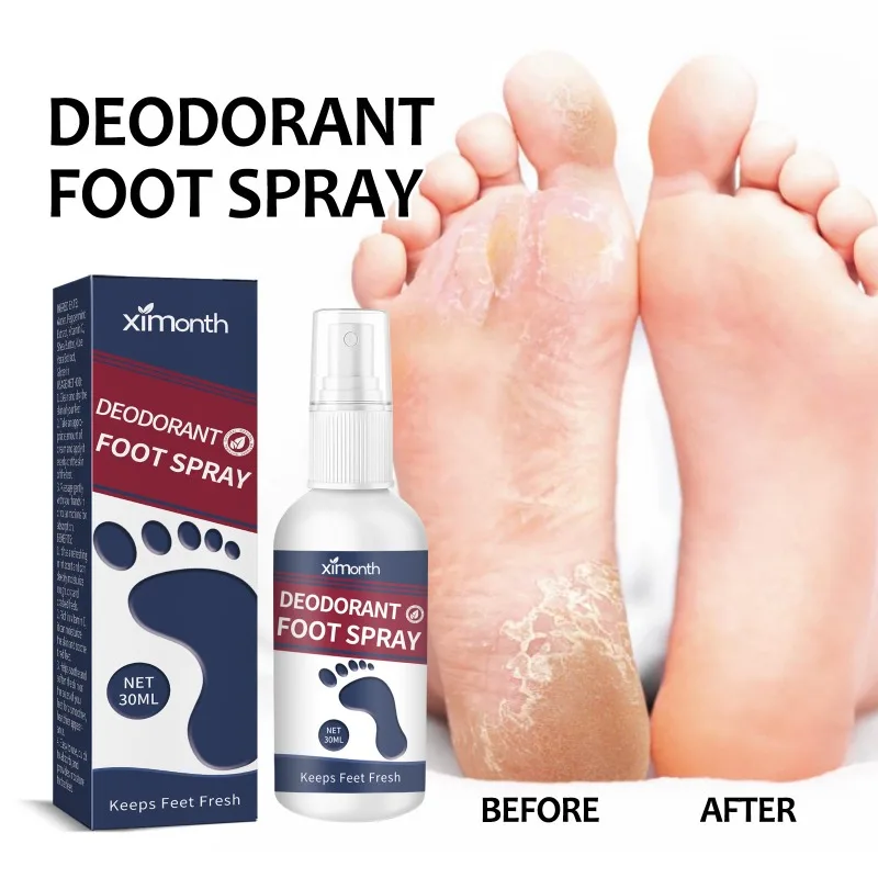 

2pcs Foot Odor Spray 30ml Odor Remover Spray Refresh Deodorant Odour Relief Heel Peeling Cracking Hydrating Foot Care Spray