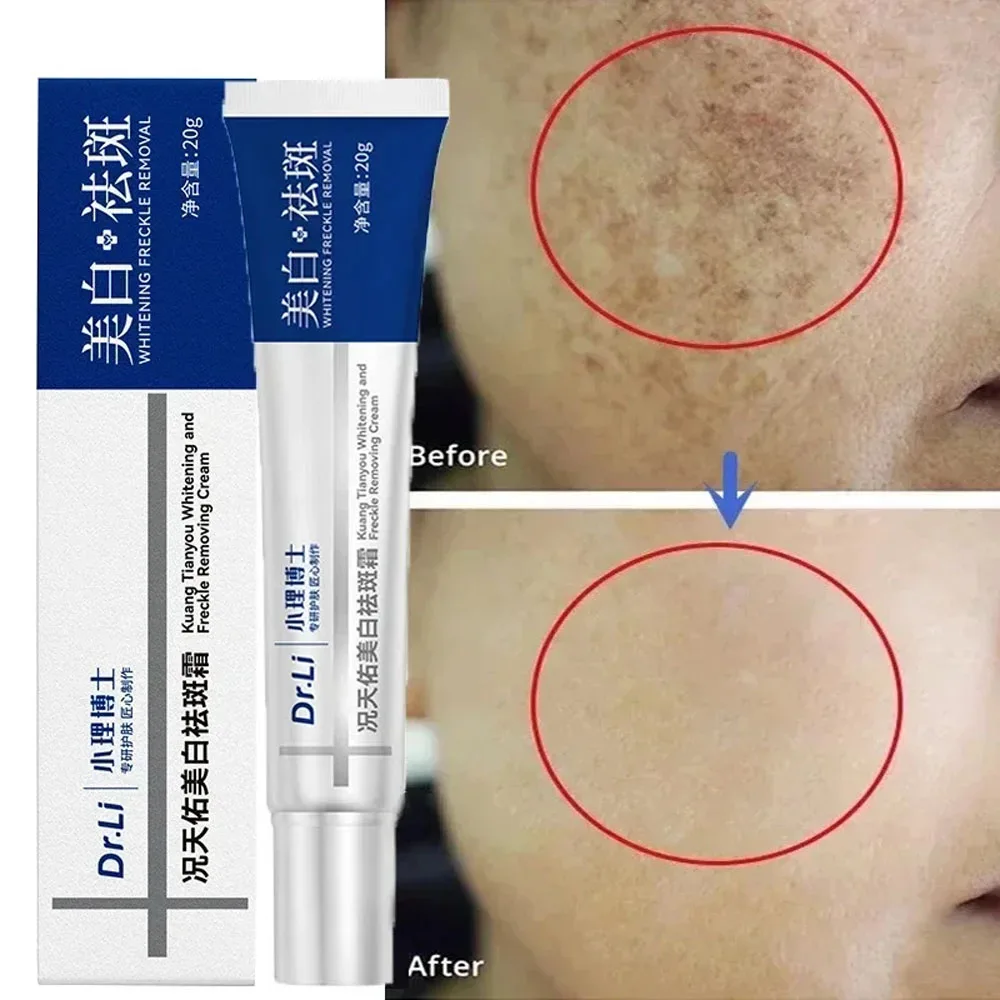 Whitening Freckle Cream Remove Melasma Dark Spots Face Cream Fade Melanin Moisturize Brighten Smooth Skin Care Korean Cosmetics