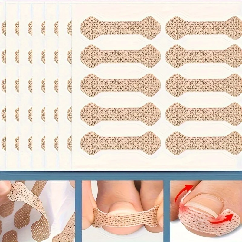 Ingrown Paronychia Toenail Corrector Strips Anti F 10pcs Ingrown Paronychia Toenail Corrector Strips Anti F 5