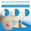 2 IN 1 Auto Skin Tag Remover Kit Micro Skin Tag Removal Device Adult Mole Stain Wart Remover Face Care Beauty Tools Dropshipping 6