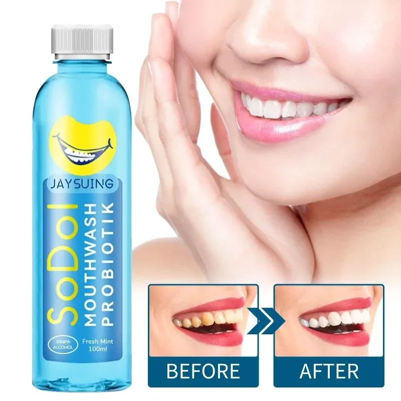 Teeth Whitening Product Teeth Whitening Essence Teeth Health Product Mouth Freshener Spray Mouthwash remove tooth stains odor clean Yellow tartar Whitening teeth Lasting fresh breath Mouth Toothpaste Oral Smell Care