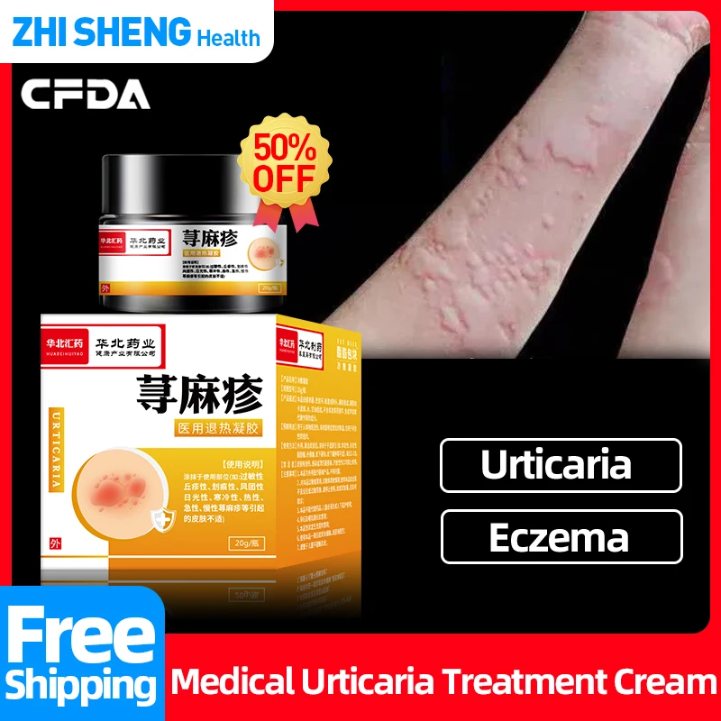 UrticariaPorPielTreatmentCreamEczemaMedicineApplyToAcute