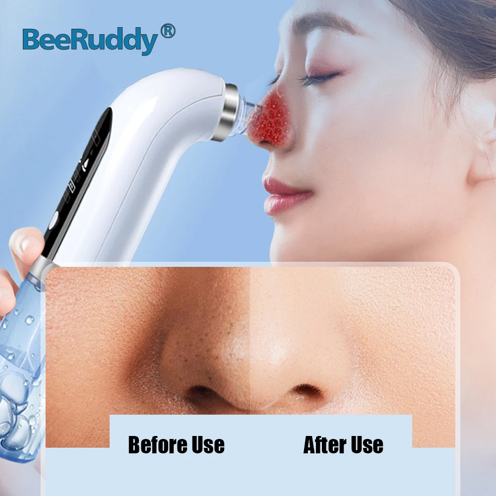 BeeRuddy Small Bubble Black Dot Acne Pimple Blackhead Remover Tool Rechargeable Pore Clean Water Cycle Nose Face Vacuum Cleaner |