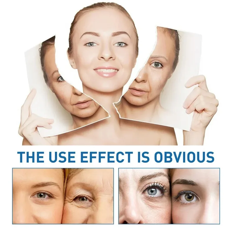 ZS 5box Effective Exosomes Therapy Scar Heal Acne Removal Anti-inflammatory EGF Anti-aging Glow Boosting Firmness Cell Renewal