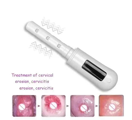 Gynecological Inflammation Treatment Device LED Red Light Blue Light Massage Treat Chronic Pelvic Inflammatory Disease Vaginitis