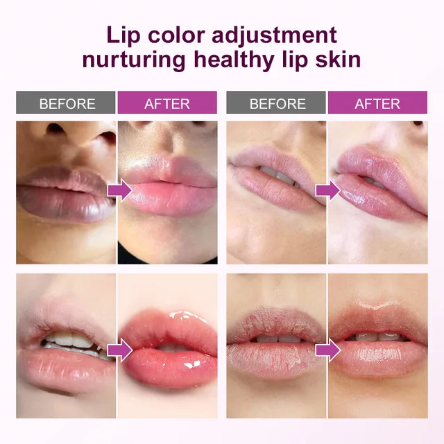 Remove Dark Lip Balm Fast Lightening Pink Lip Exfoliating Fade Lip Line Dead Skin Moisturizer Korean Care Products Beauty Health