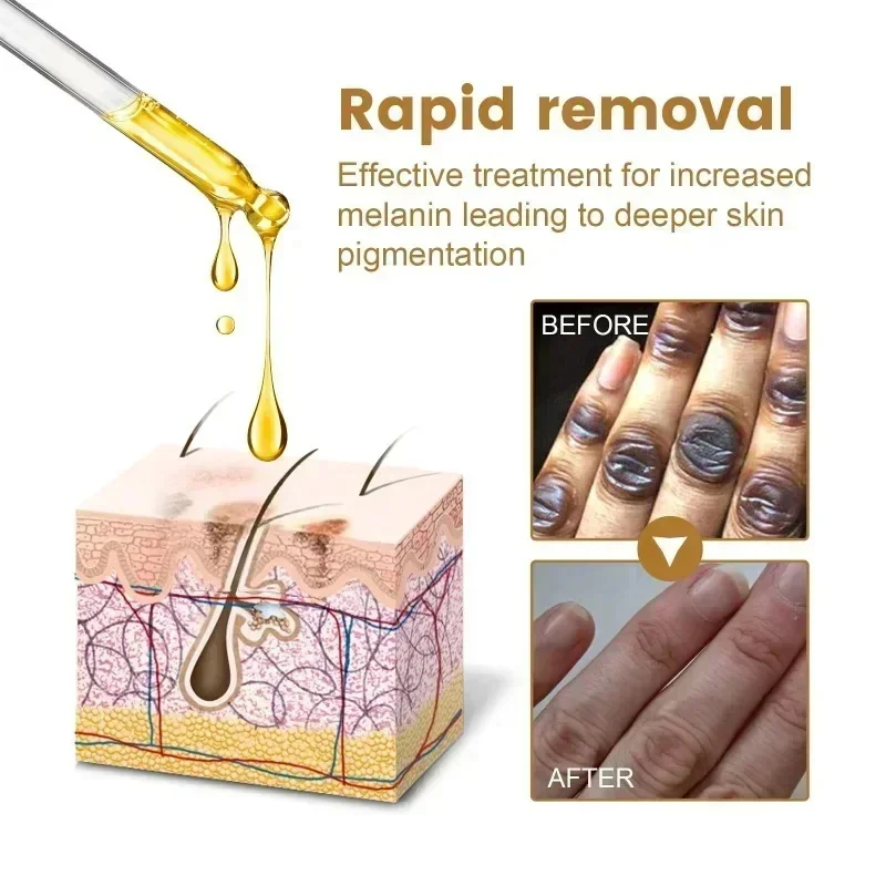 Dark Knuckles Fast Brighten Serum Elbows Hands Knee Armpits Brightening Serum Clarify Black Skin Lighten Stains Remover Essence 5