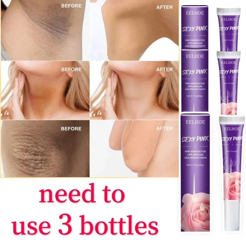 Рисунок 2 - Отбеливающий крем с частными частями для женщин