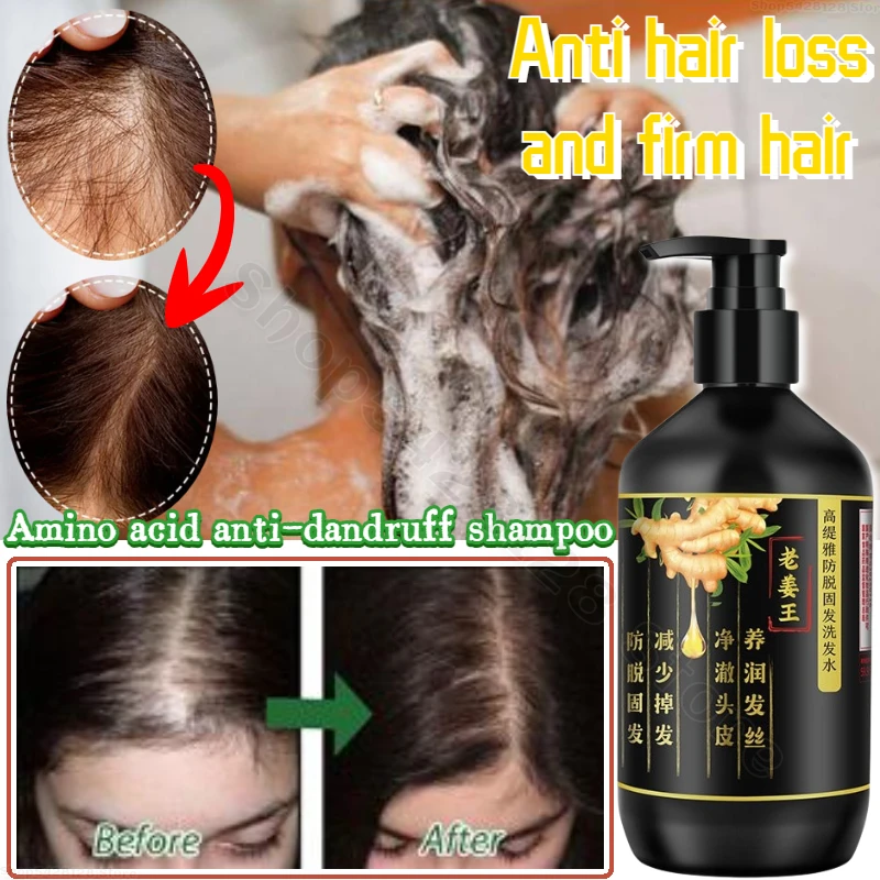 

Ginger Anti-stripping Shampoo Hair Root Oil Control Fluffy Anti-dandruff Nourishing Scalp Shampoo 500ml Shampoo Profissional