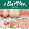 Unisex Deep Cleansing Nose Strips for Acne & Blackhead Removal Shrink Pore Nose Black Head Stickers Skin Care Patch 5