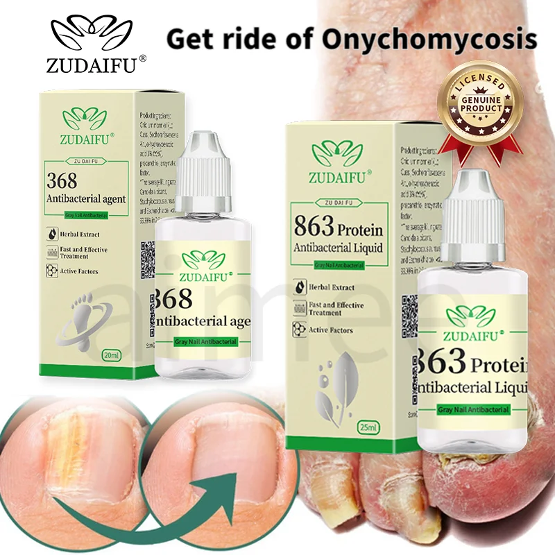 

Anti Infection Fungal Nail Treatment Liquid Foot Care Essence Whitening Toe Nail Fungus Removal Gel Paronychia Onychomycosis