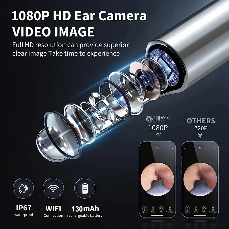 스마트 비주얼 귀 클리너 귀 스틱 검이경, USB C 충전 내시경, 왁스 제거 도구, 귀이개 미니 카메라, 건강 관리 세트, 1296P
