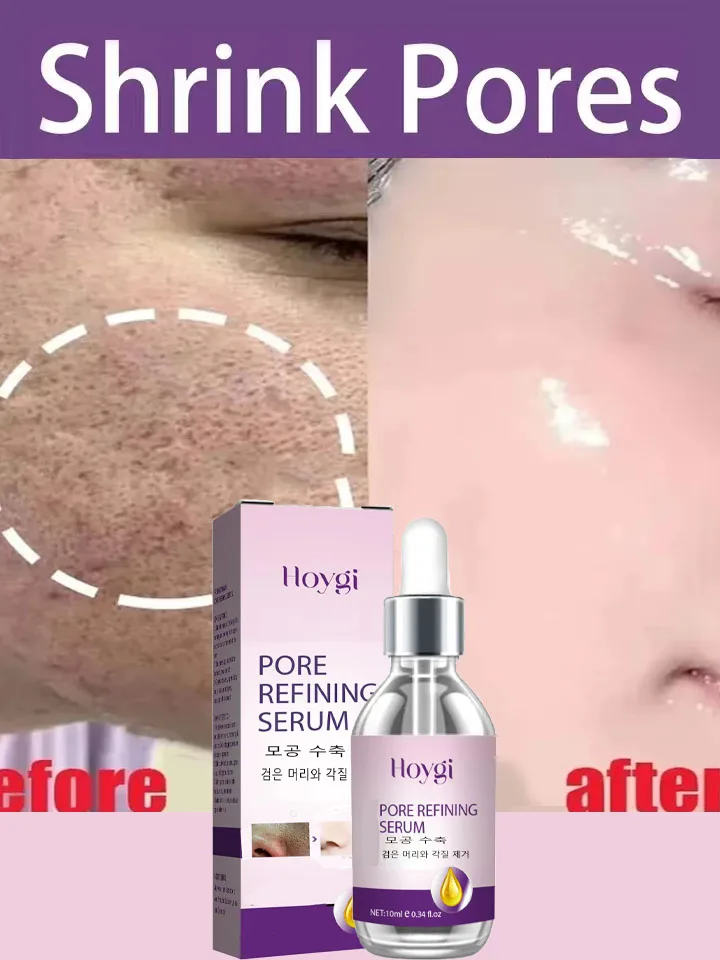 Skin texture, pore refinement and regeneration, no acne facial essence