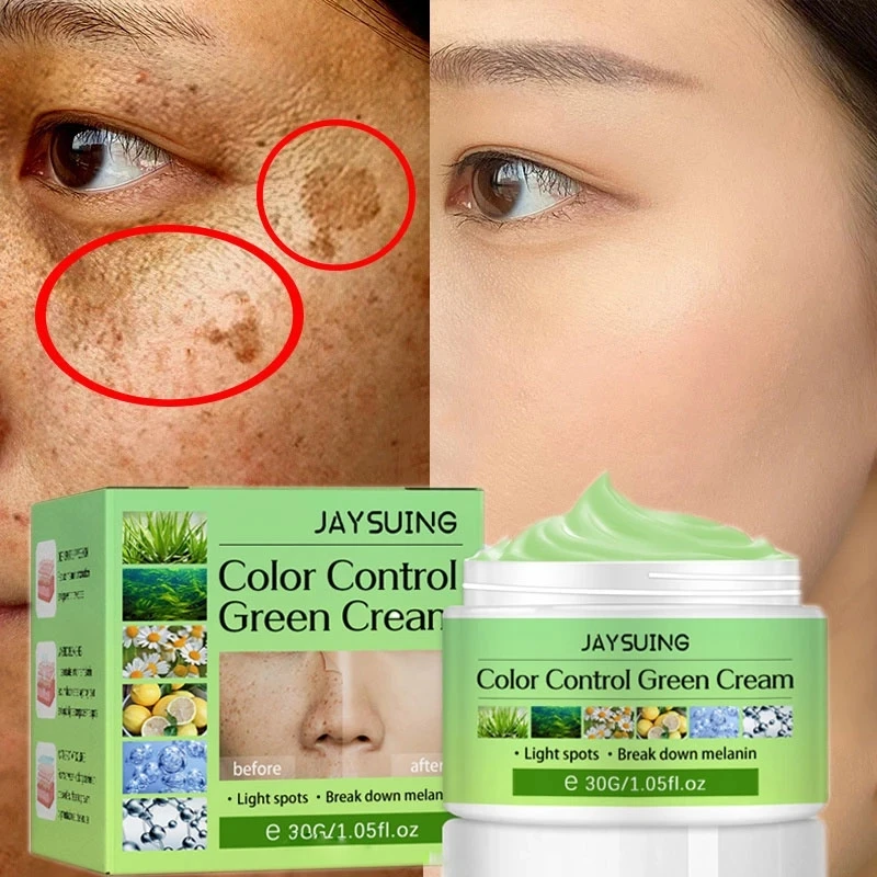 Whitening Freckles Cream Remove Melasma Dark Spot Lightening Melanin
