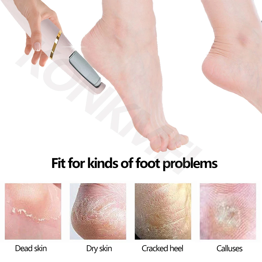 New Electric Pedicure Tool Film Foot Dead Skin Callus Remover Feet Exfoliator Pumice Stone for Heel Grinding Device For Gifts 3