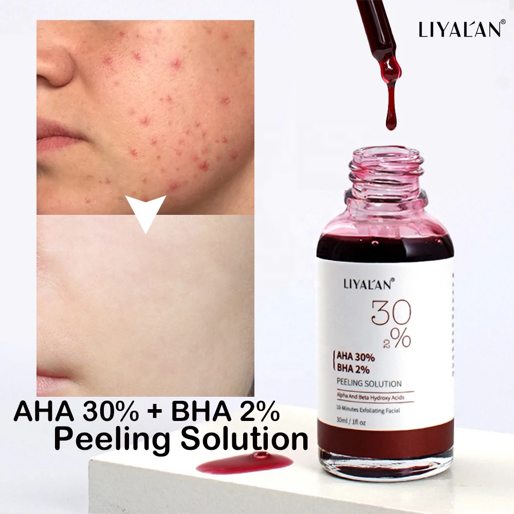 3PCS AHA 30 BHA 2 Peeling Solution Remove Acne Repair Scars Fade Fine