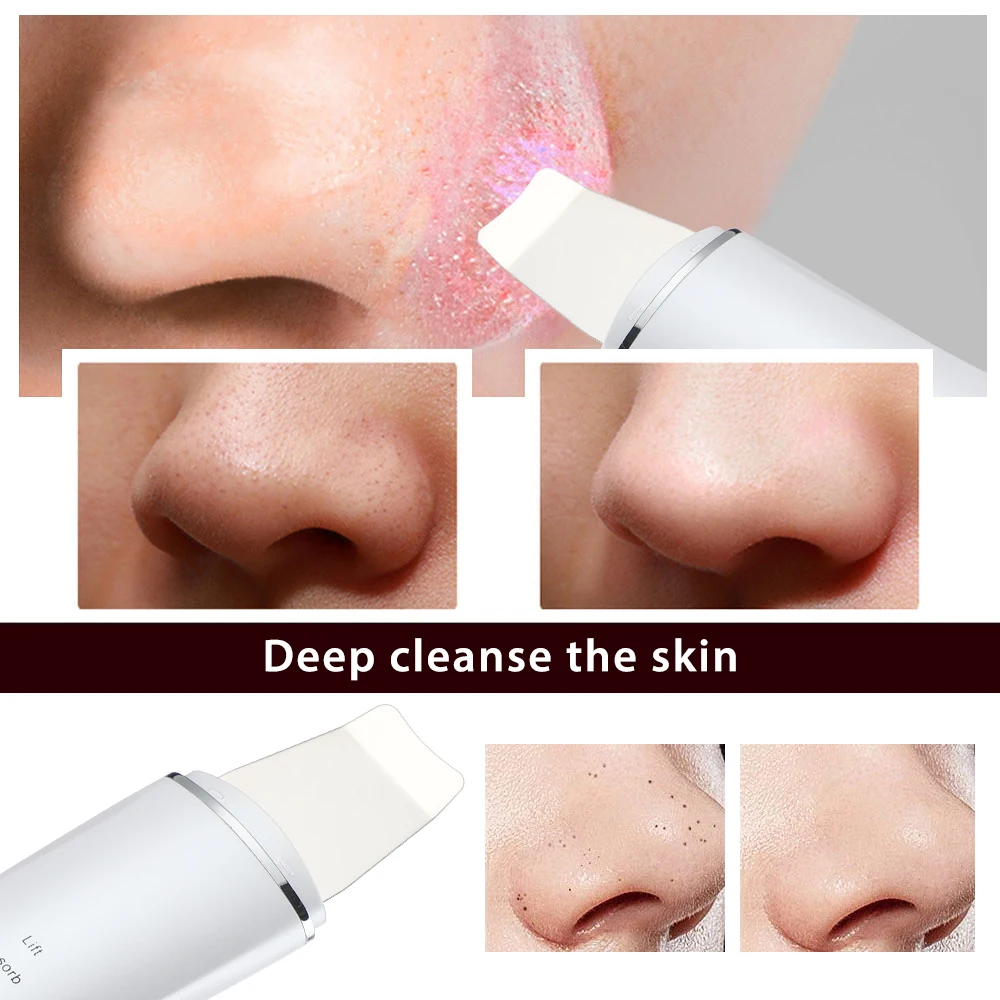 Ultrasonic Skin Scrubber Vibration Face Spatula Blackhead Remover Shovel Clean Cavitation Peeling Facial Lifting Skin Care Tools