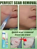 Laser scar repair 3