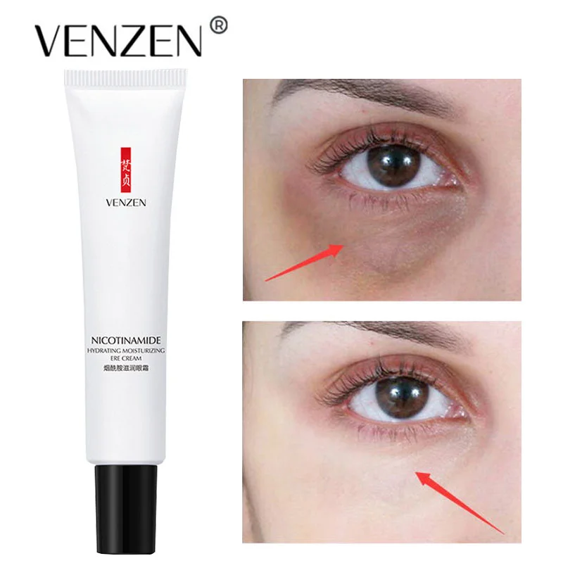 Nicotinamide Eyes Cream Whitening Dark Circles Remove Eye Bags Anti