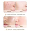4Color Liquid Contouring Concealer Cream Makeup Waterproof Moisturizing Lasting Cover Acne Dark Circles Foundation Face Cosmetic 3