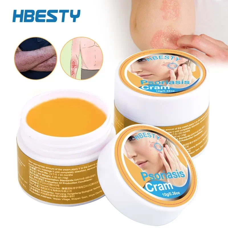 Herbal Anti-itch Psoriasis Treatment Ointment Eczema Hand Foot Tinea Against Fungi Itching Dermatitis Skin antipruritic Cream