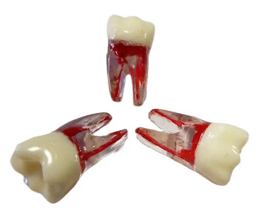 

5~100Pcs36# Dental Endo Files Practise File Training Root Canal Crown UR Pulp Not Opened Model