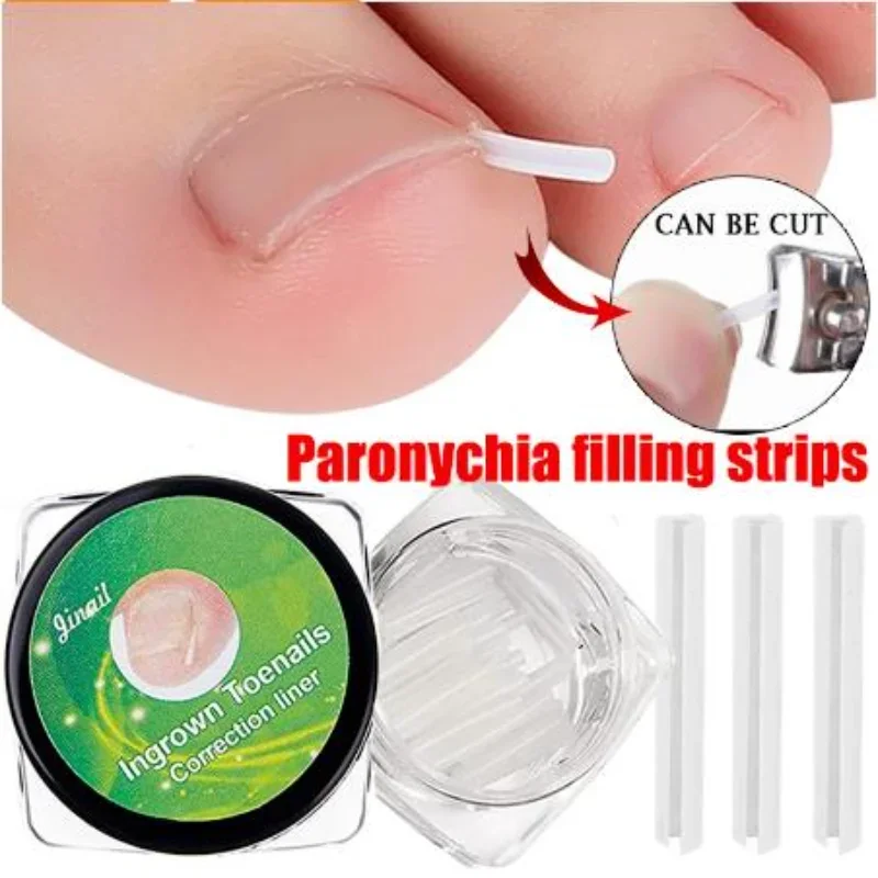 10pcs Ingrown Toenail Correction Tool Ingrown Toe Nail Treatment Elastic Patch Sticker Straightening Clip Brace Pedicure Tool