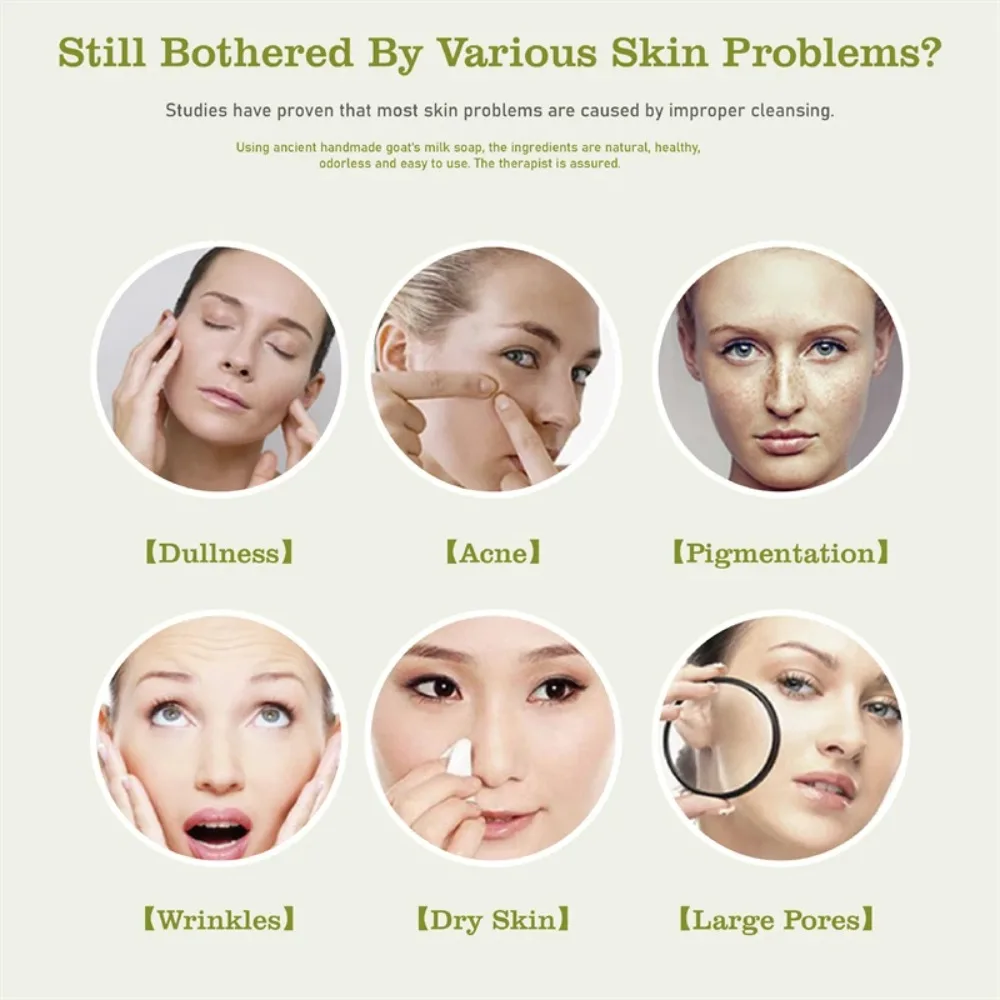 Chicken Skin Removal Body Whitening Soap Removal Dead Skin Moisturizing Bleaching Soap Body Brighten Deep Clean Goats Milk
