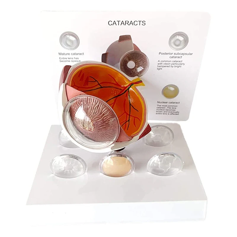 

Human Cornea Eyeball Demonstration Teaching Prop Cataract Anatomy Medical Teaching Model