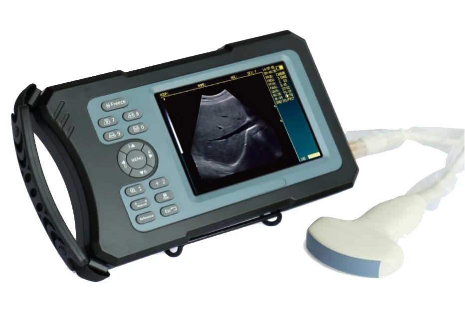 Highest Cost-effective Handheld Portable 3 in 1 Wifi & USB Wireless Ultrasound Probe
