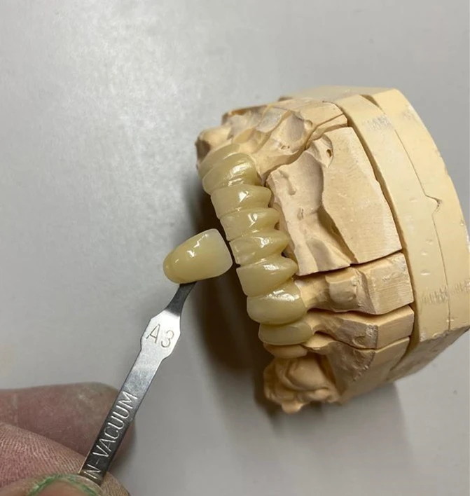 thumb
