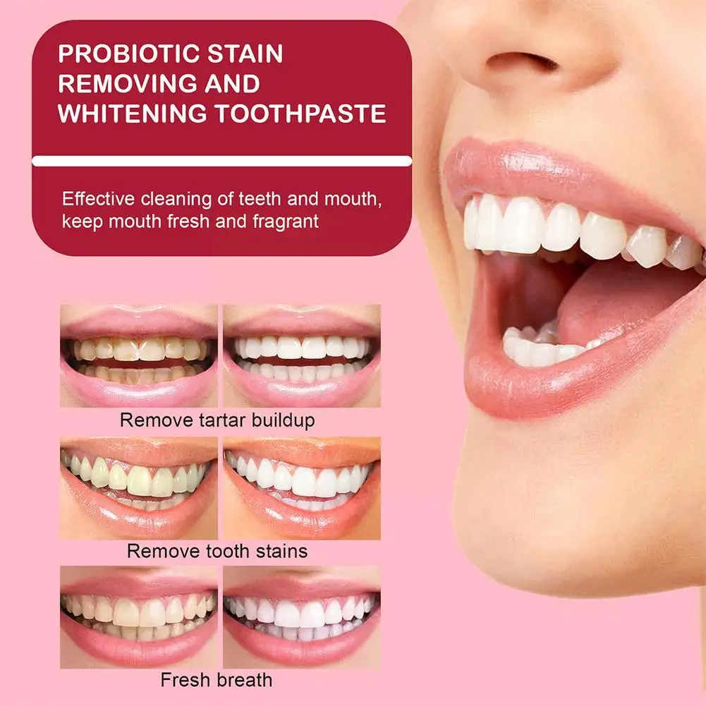 Sp4 Teeth Whitening Toothpaste Tooth Correction Whitener Original 120g Teeth Whitening Purple Toothpaste Non-invas R8q5