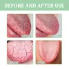 Fissured Tongue Relief Spray Teeth Clean Deodorant Prevent Calculus Remove Bad Breath Supplies Deodorizing Oral Spray 4