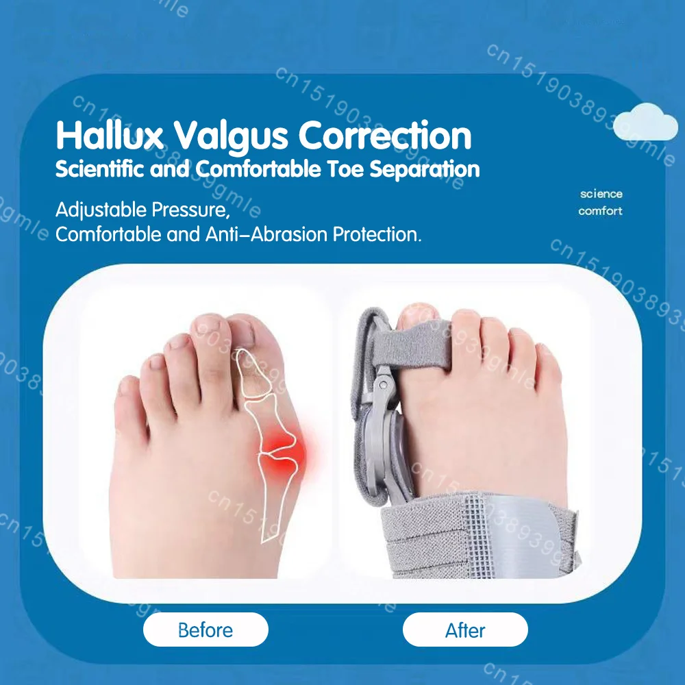 Hallux Valgus Corrector Big Toe Orthopedic Toe Straightener Anti-Slip Adjustable Toe Correction Pedicure Finger Toe Corrector
