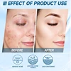 Oligopeptide Anti Acne Face Serum EGF Acne Treatment Essence Diminish Pigmentation Moisturizing Skincare Repair Skin Barrier 4