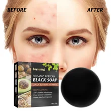 

120g Black Soap Deep Cleaning Anti Mites Handmade Soap Acne Removal Exfoliating Moisturizing Face Body Cleaning Soap