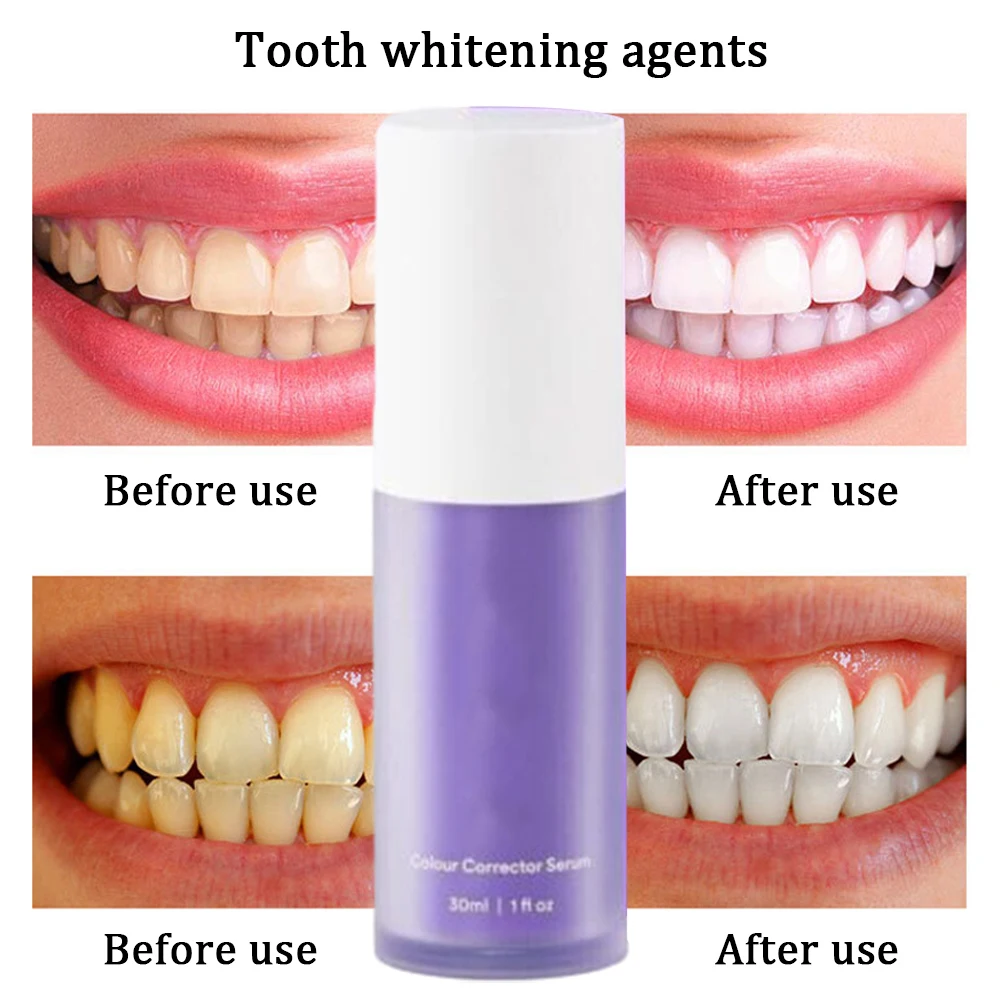 1-10pcs V34 30ml Teeth Toothpaste Remove Stains Reduce Yellowing Care Anti-Pigmentation Tooth Whitening teeth whitening product teeth health product