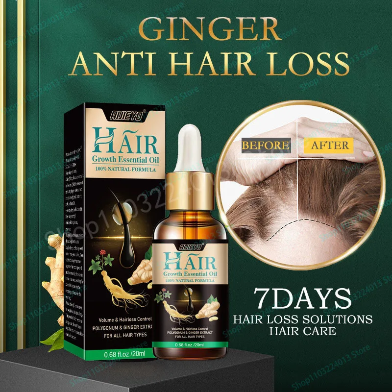 Description Picture 3 of itemNatural Ginger Hair Growth Spray Hair Roots Fast Grow Anti Hair Loss Serum Liquid Scalp Damaged Treatment Repair Beauty Health