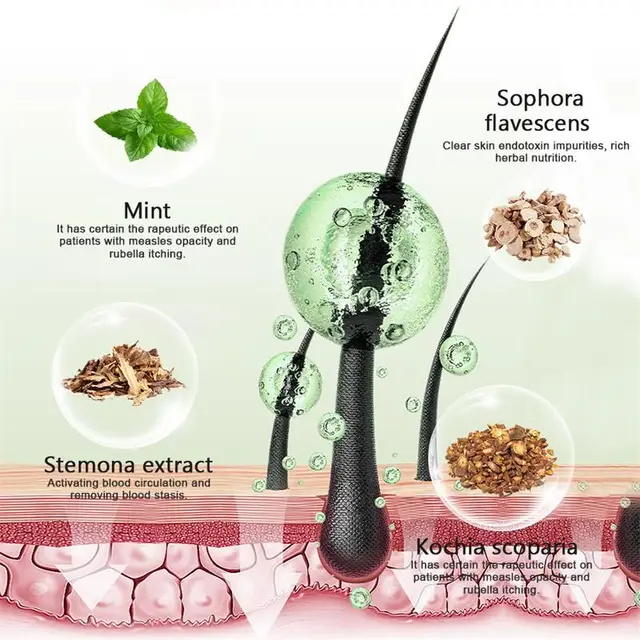 Body Acne Cream – Clear, Smooth & Repair Skin