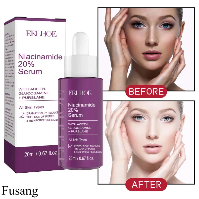 

Nicotinamide Remove Acne Serum Shrinking Pores Freckles Essence Whitening Anti-Aging Products Firming Skin Fade Dark Spots Cream