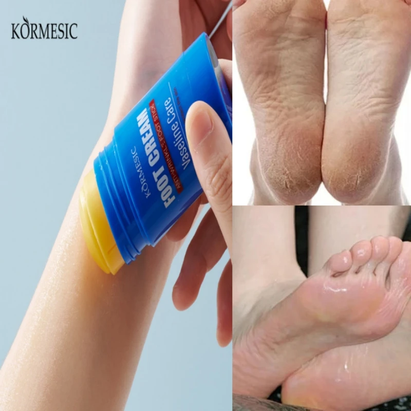 Description Picture 3 of item60% Urea Foot Cream Feet Heel Anti-Chapping Ultra-hydrating Softening Dry Cracked Product Gentle Exfoliation Daily Hand Foot Car