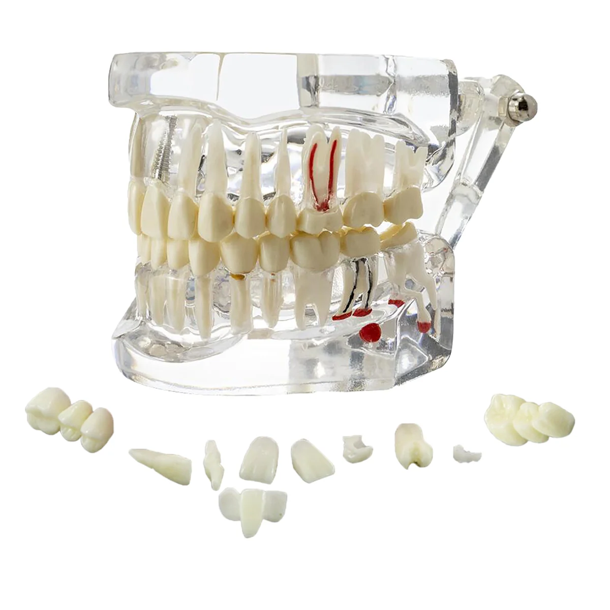

Dental Teeth Model Teeth Study Demo Model Transparent Implant Teeth Model For Dentist Student Study Teaching Dentist Product