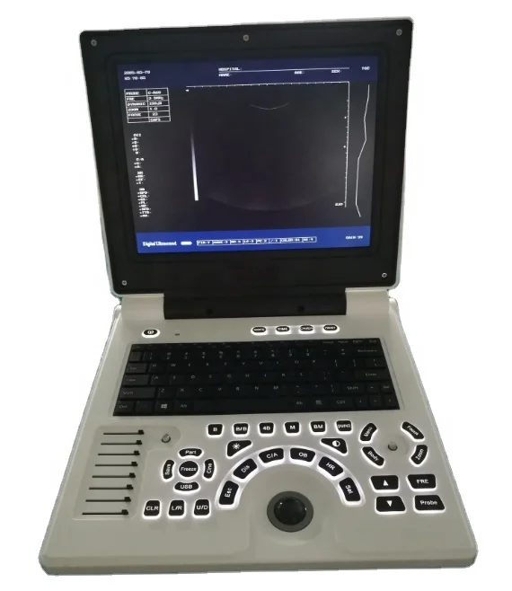 

Portable 3D color display Full Digital Color Doppler Ultrasound Scanner Diagnostic System